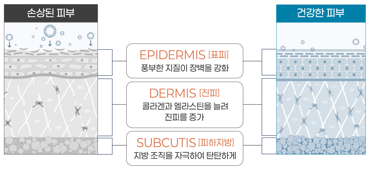 엑소좀