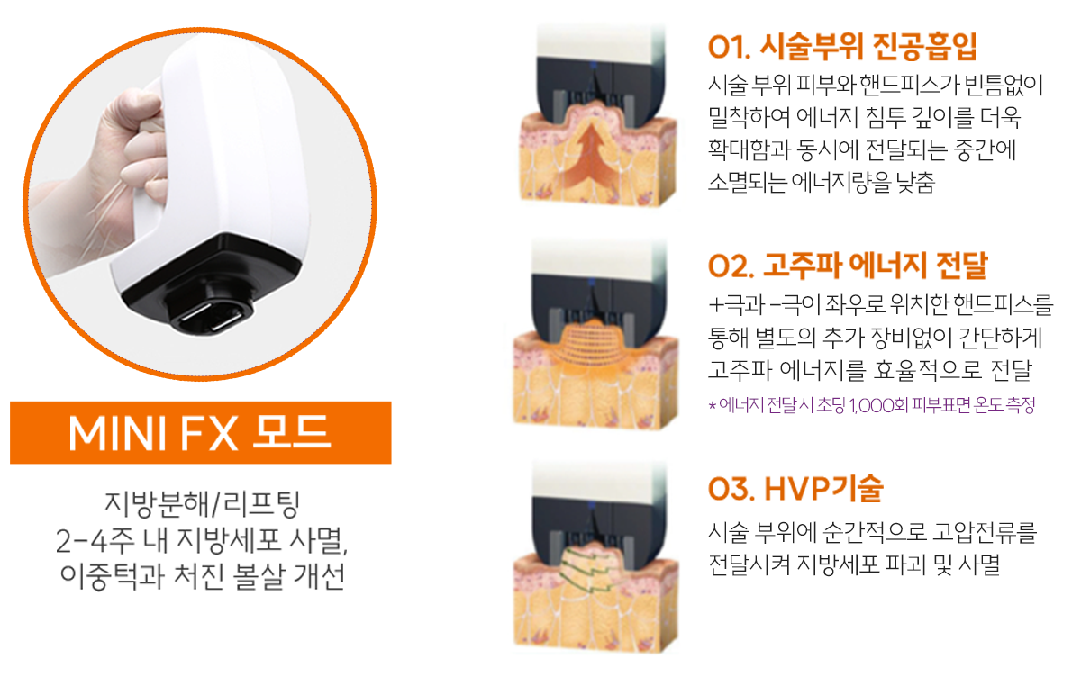 인모드FX