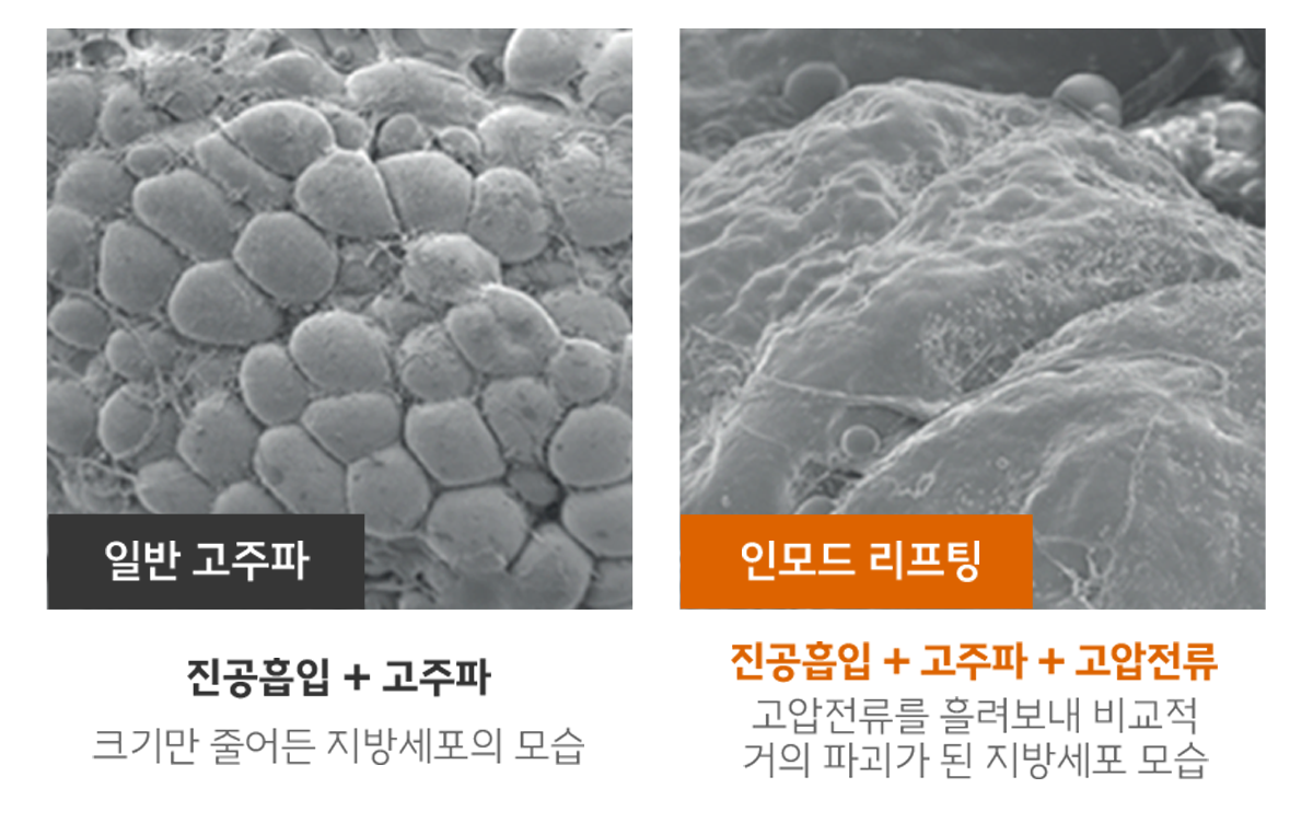 인모드FX