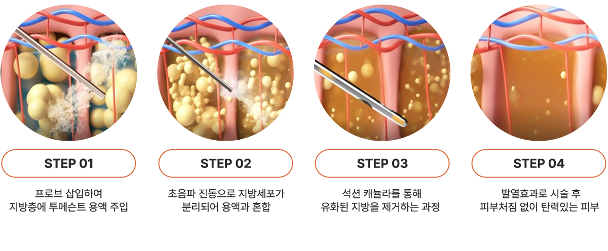 엘싸