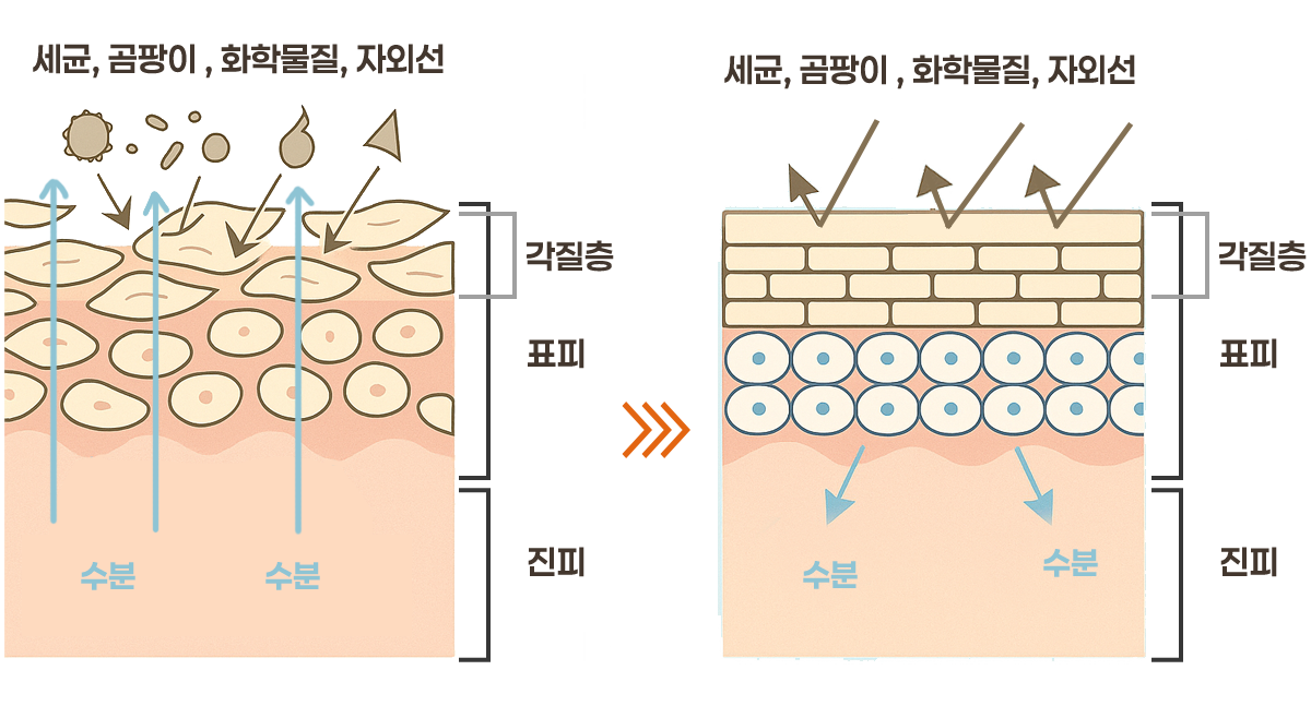 리쥬란힐러러