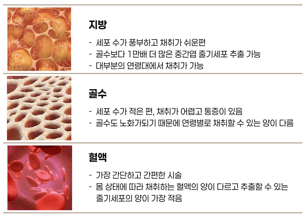 줄기세포