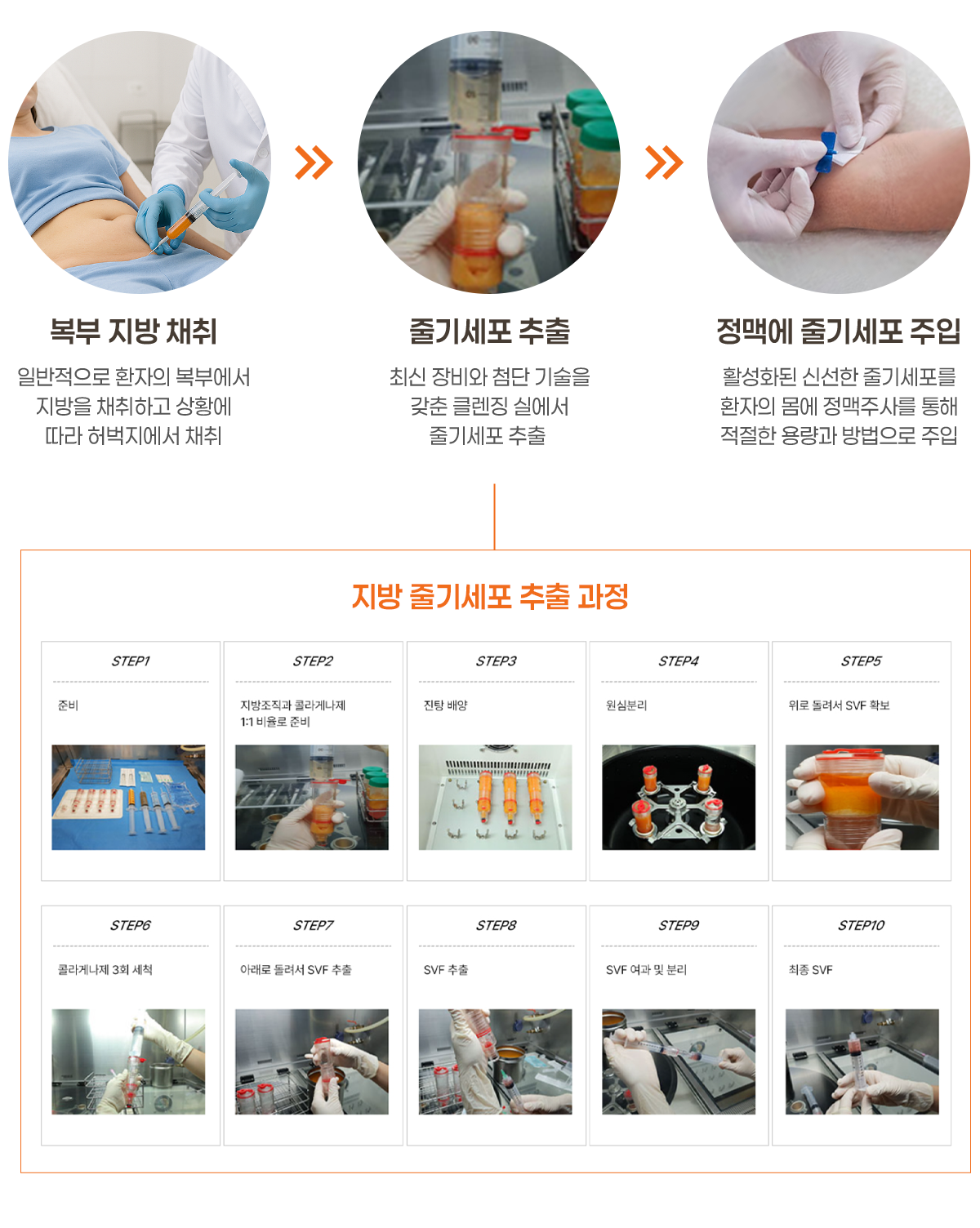 줄기세포
