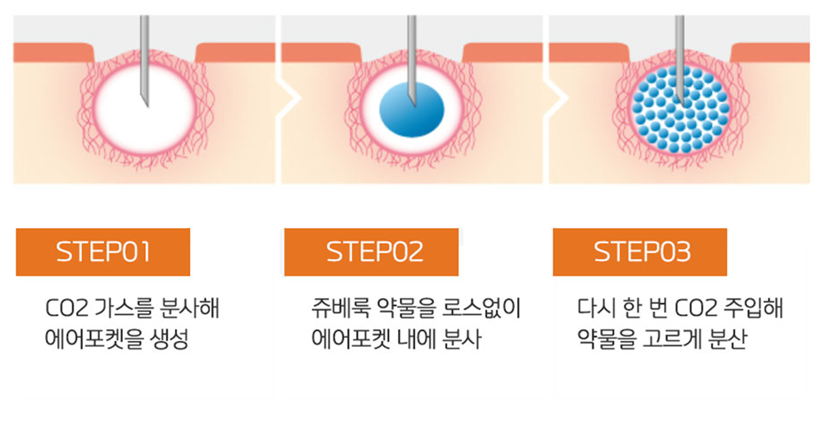 트리필프로